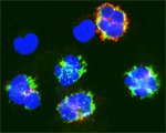 ATG7 | Autophagy-related protein 7 (human) in the group Antibodies Human Cell Biology / Human Developmental Biology at Agrisera AB (Antibodies for research) (AS13 2699)